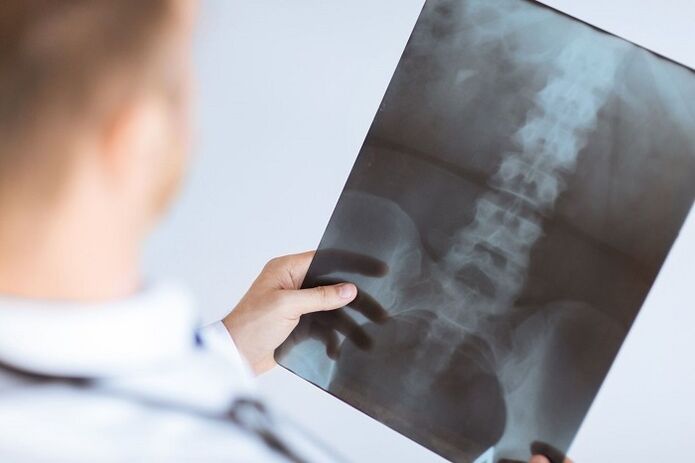 Opcje diagnostyczne osteochondrozy lędźwiowej