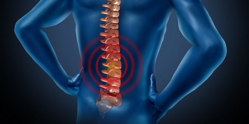 Osteochondroza obszaru lędźwiowego