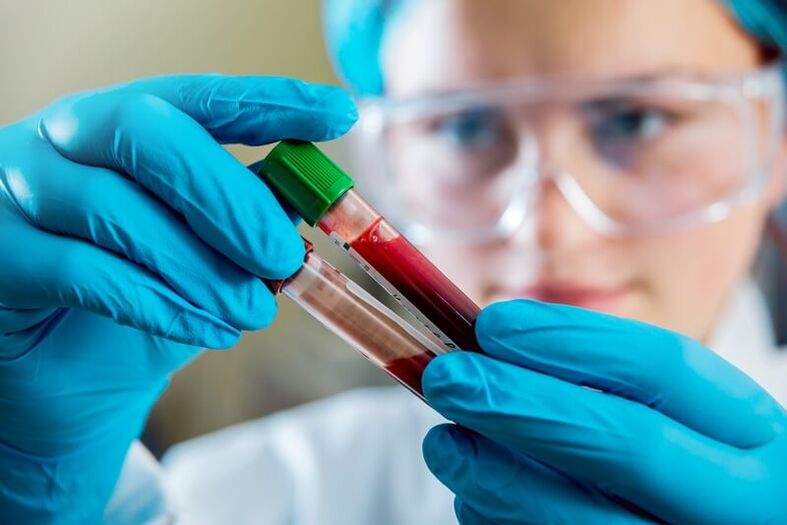 Pełne badanie krwi w celu zdiagnozowania bólu krzyża